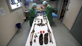 Tengkorak tersebut ditemukan ketika pekerja konstruksi jalan di dekat medan perang Douaumont. Identifikasi ini dilakukan di Rumah Sakit Verdun, Perancis Timur. (REUTERS/Christian Hartmann)