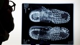 Asisten forensik Prancis Manu Robas melihat gambar-gambar X-ray yang menunjukkan sepatu bot yang dikumpulkan di samping sisa-sisa tentara yang tidak diketahui. (REUTERS/Christian Hartmann)