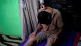Seorang pasien, Mohamed Abdelfattah (29), mengatakan bahwa terapi sengatan lebah ini memperbaiki suasana hatinya dan membuatnya merasa sehat. (REUTERS/Amr Abdallah Dalsh)
