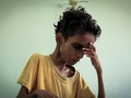 FOTO: Bayang Wabah Kelaparan Akibat Perang Yaman