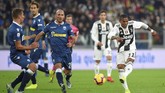 Pemain Juventus termasuk Douglas Costa dan para pemain SPAL mendapat coretan lipstik merah di pipi untuk kampanye antikekerasan terhadap kaum wanita. Juve menang 2-0 atas SPAL. (REUTERS/Massimo Pinca)