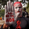 PBB Warning! Trump Bisa Bikin 6 Juta Orang di Dunia Kena HIV/AIDS