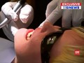 VIDEO: Operasi Rahang 3D Pertama Berhasil
