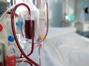 Heboh Bocil-bocil Cuci Darah di RSCM, Komunitas Pasien Hemodialisis Angkat Bicara