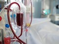 Yang Terjadi di Tubuh Saat Proses Cuci Darah