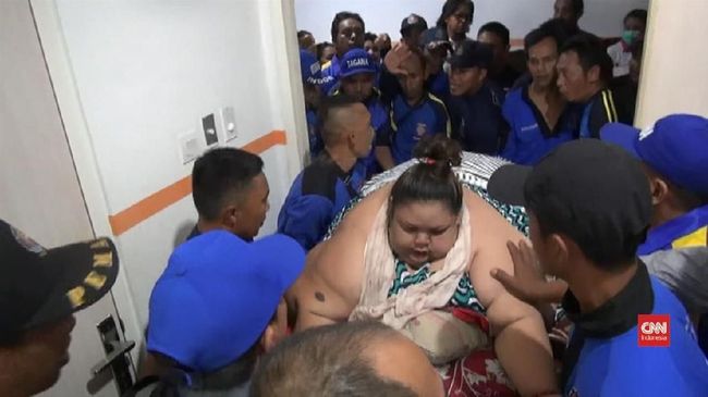 Bayang-bayang Obesitas Masih Menghantui Orang Indonesia