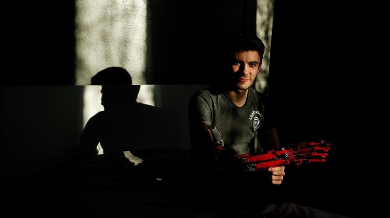 David Aguilar, 19 tahun. Mahasiswa Universitas Internacional de Catalunya Spanyol ini membuat sendiri lengan dari potongan Lego