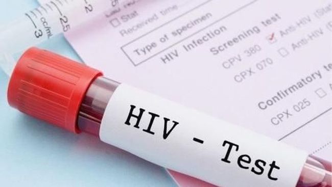 Kini Tes Hivaids Bisa Dicek Sendiri Dengan Mudah Di Rumah