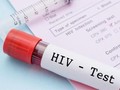 Kini Tes HIV/AIDS Bisa Dicek Sendiri dengan Mudah di Rumah