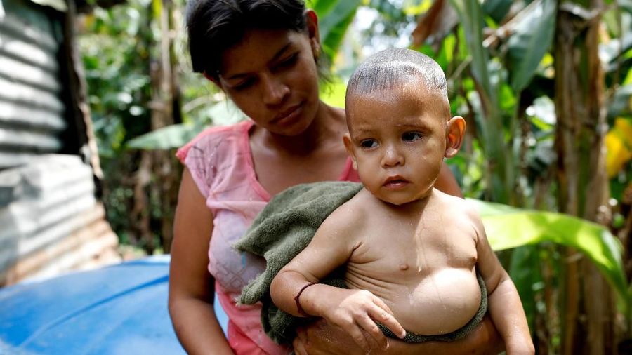 Keruntuhan ekonomi Venezuela membuat makanan menjadi tidak terjangkau dan berharap oposisi akan berhasil membawa bantuan dari asing yang sangat dibutuhkan.
