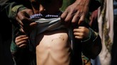 Setidaknya, hewan-hewan hidup khususnya hewan ternak mati gara-gara rabies tiap tahunnya. (REUTERS/Mohamed al-Sayaghi)