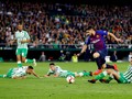 Cedera Pergelangan Kaki, Suarez Tetap Bisa Tampil Lawan MU