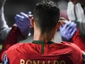 Juventus Pastikan Ronaldo Hanya Cedera Ringan