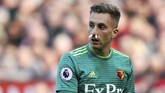 Hidung Gerard Deulofeu harus disumbat dengan kapas untuk mencegah darah keluar. (REUTERS/Andrew Yates)