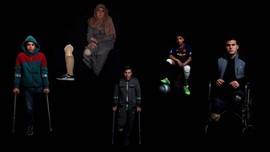 FOTO: Kaki Palsu untuk Mereka yang Terluka di Jalur Gaza