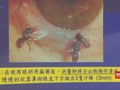 VIDEO: Empat Ekor Lebah Hidup di dalam Mata Wanita Taiwan