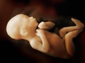 Korea Selatan Legalkan Aborsi Setelah 66 Tahun Larangan