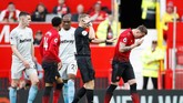 Bek Man United Phil Jones (kanan) sempat mengalami luka parah di dahi sebelah kanan usai tersikut Declan Rice. Sempat mendapat perawatan, Jones tetap bisa melanjutkan pertandingan dan memberikan kemenangan bagi Man United. (Action Images via Reuters/Carl Recine)
