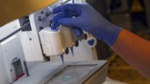 Teknologi yang dikembangkan Erturk dan tim membantu ilmuwan dari berbagai bidang penelitian biomedis memanfaatkan tampilan resolusi tinggi dari organ dan tubuh hewan pengerat secara utuh. (REUTERS/Michael Dalder)