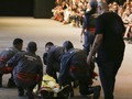 Model Brasil Meninggal Setelah Pingsan di Catwalk