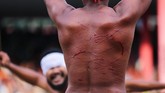 Ketika pertempuran selesai, pemuda kedua desa tersebut menggobati lukanya dengan menggunakan getah pohon jarak. Namun tak ada keluh kesah yang terlontar dari mereka. (ANTARA FOTO/Atika Fauziyyah)