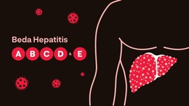 INFOGRAFIS: Beda Hepatitis A, B, C, D, dan E