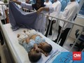 Bayi Kembar Siam Tapanuli Jalani Operasi Pemisahan 23 Juli