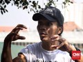 Kaka Slank Bertahap Jalani 'Diet' Plastik
