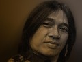Gejala Awal Kanker Otak Seperti yang Diderita Agung Hercules