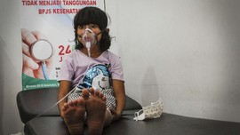 FOTO: Korban Kabut Asap Karhutla