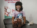 PBB Sebut Polusi Karhutla Indonesia Bahayakan 10 Juta Anak