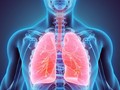 Hari Pneumonia Sedunia, Penyakit Paru Mematikan Intai Balita