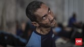 Sementara prevalensi gangguan mental emosional (GMA) tercatat sebanyak 9,8 persen dari total penduduk berusia kurang dari 15 tahun. (CNN Indonesia/Bisma Septalisma)