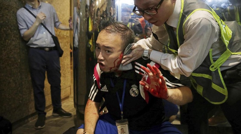 Aksi protes pro-demokrasi di Hong Kong dihiasi dengan penikaman pisau yang melukai salah satu anggota dewan lokal Hong Kong Minggu (3/11/2019)
