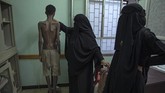 Sejumlah imigran yang selamat mendapatkan berbagai luka benda tumpul dan cambukan di beberapa bagian tubuh. (AP Photo/Nariman El-Mofty)
