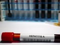 Depok KLB Hepatitis A, Pemkot Gratiskan Pengobatan