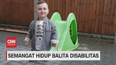 VIDEO: Semangat Hidup Taylor, Balita Disabilitas