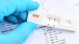 Tes HIV Mandiri Tak Bisa Jadi Patokan Utama Diagnosis
