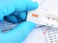 Tes HIV Mandiri Tak Bisa Jadi Patokan Utama Diagnosis