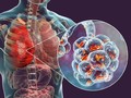 WHO Konfirmasi Virus Misterius China Menyebar ke Thailand