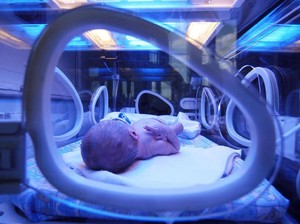 Benarkah Bayi Lahir Prematur Lebih Mudah Sakit? Dokter Bilang Gini