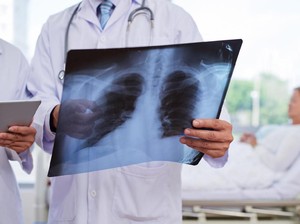 WNA Bergejala Pneumonia di Bali Akan Dirujuk ke 3 RS Rekomendasi Kemenkes