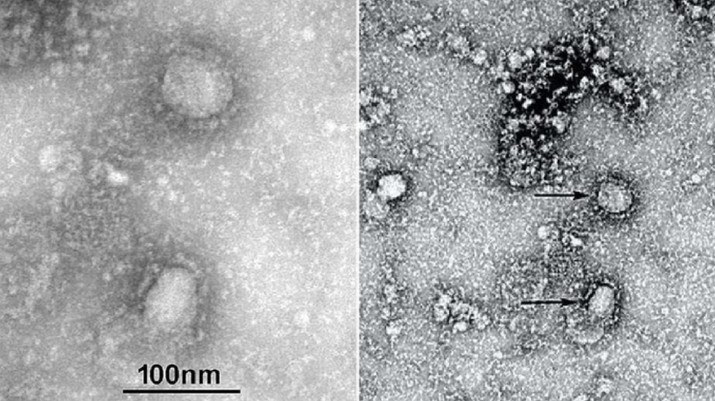 Penampakan virus corona yang diisolasi (Foto: NMDC)