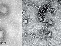Wabah Flu Ini Sedang Menyebar di AS, Sebabkan 900 Kematian per Tahun