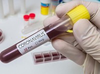 Corona Masih Mengganas, AS Konfirmasi Lagi Kasus Baru