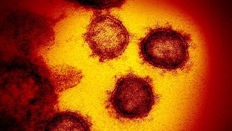 Begini Penampakan Virus Corona Jika Dilihat Dari Microskop.