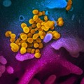 Microsoft Akui 2 Karyawannya Terjangkit Virus Corona