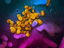 Kian Luas, AS Laporkan Kematian Pertama Akibat Virus Corona