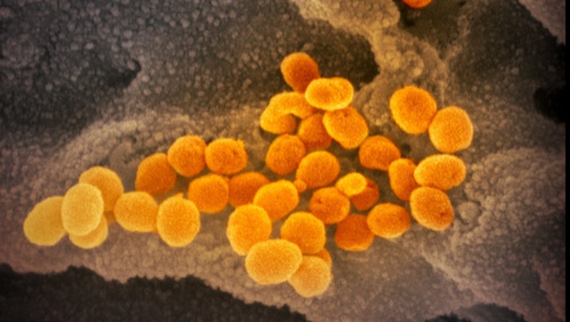Begini Penampakan Virus Corona Jika Dilihat Dari Microskop.