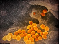 Tangkal Virus Corona, Dokter Ini Sarankan Rajin Bersihkan HP